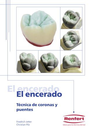 encerado tecnicas 1 320