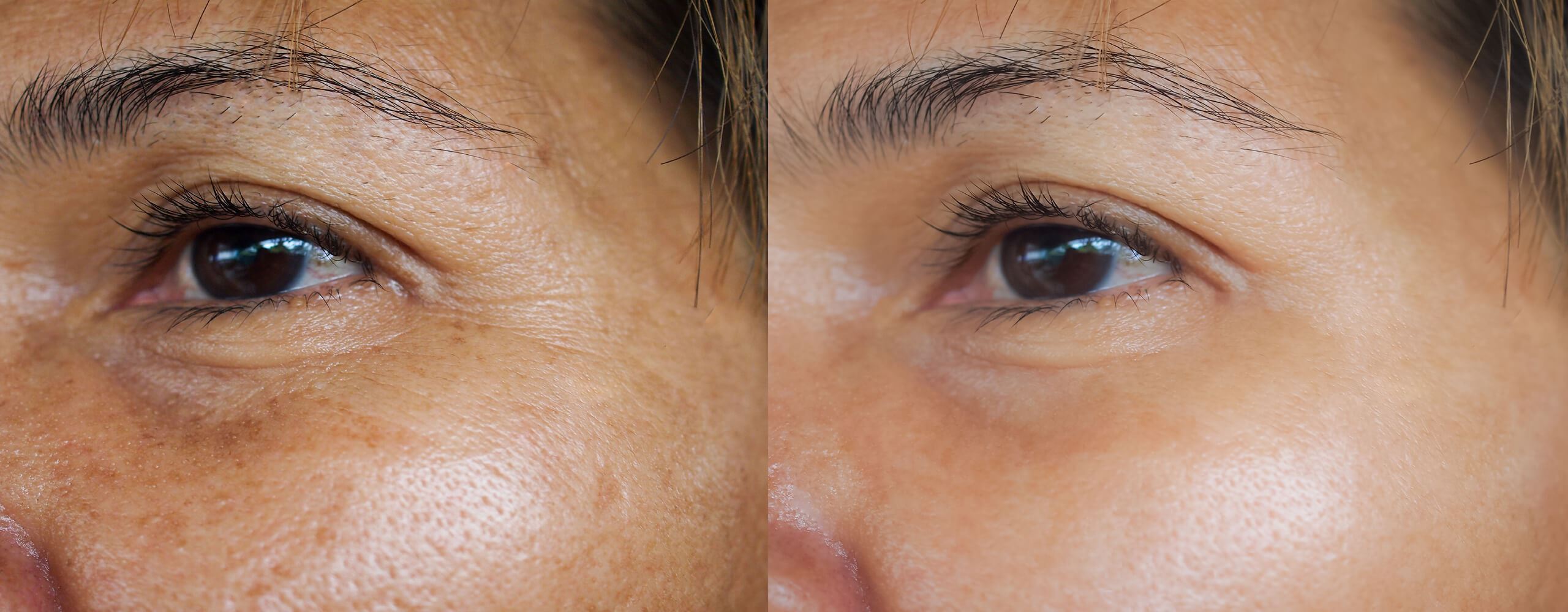 Antes y después de limpiar una mancha